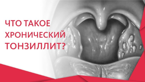 Галерея изображение №1